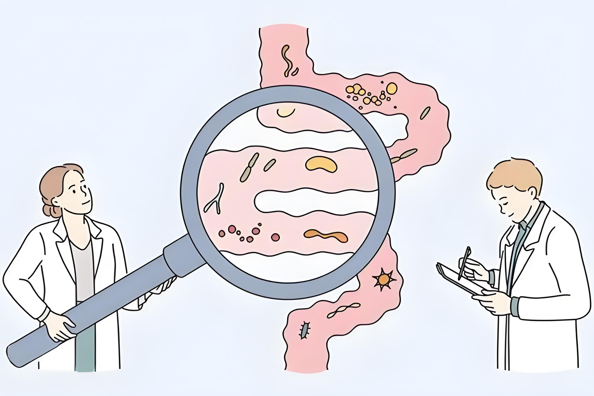 肠易激综合征：是否需要进行肠胃镜检查？